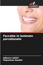 Faccette in laminato porcellanato