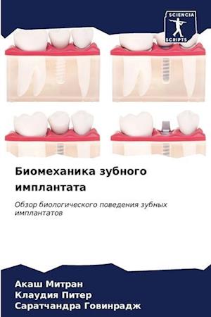 Biomehanika zubnogo implantata