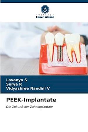 PEEK-Implantate