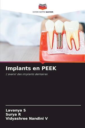 Implants en PEEK