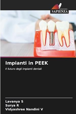 Impianti in PEEK