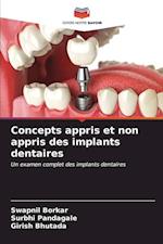 Concepts appris et non appris des implants dentaires