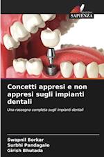 Concetti appresi e non appresi sugli impianti dentali