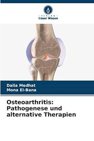 Osteoarthritis: Pathogenese und alternative Therapien