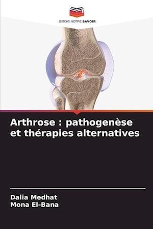 Arthrose : pathogenèse et thérapies alternatives