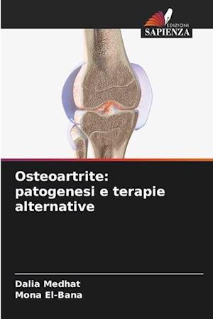 Osteoartrite: patogenesi e terapie alternative