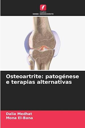 Osteoartrite: patogénese e terapias alternativas