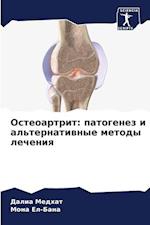 Osteoartrit: patogenez i al'ternatiwnye metody lecheniq