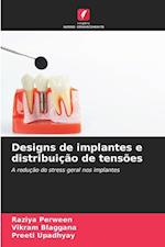 Designs de implantes e distribuição de tensões