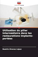 Utilisation du pilier intermédiaire dans les restaurations implanto-portées