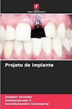 Projeto de implante