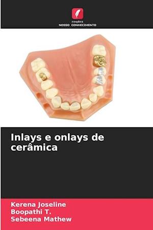 Inlays e onlays de cerâmica