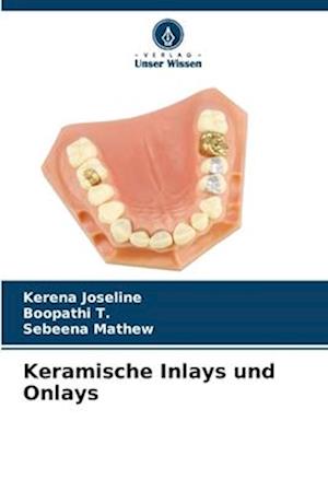 Keramische Inlays und Onlays