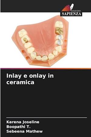 Inlay e onlay in ceramica