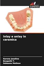 Inlay e onlay in ceramica