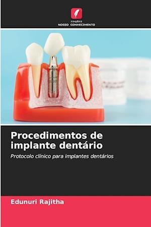 Procedimentos de implante dentário