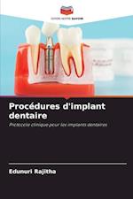 Procédures d'implant dentaire