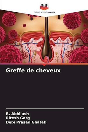 Greffe de cheveux