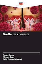 Greffe de cheveux