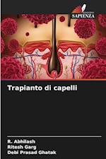 Trapianto di capelli