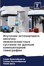 Izuchenie osteoartrita wisochno-nizhnechelüstnyh sustawow po dannym komp'üternoj tomografii