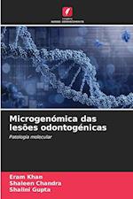 Microgenómica das lesões odontogénicas