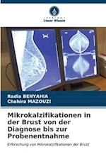 Mikrokalzifikationen in der Brust von der Diagnose bis zur Probenentnahme