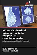 Microcalcificazioni mammarie, dalla diagnosi al campionamento
