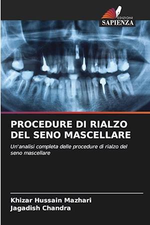 PROCEDURE DI RIALZO DEL SENO MASCELLARE