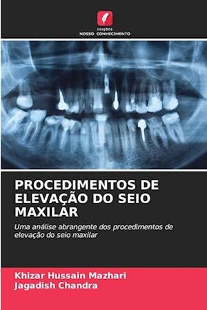 PROCEDIMENTOS DE ELEVAÇÃO DO SEIO MAXILAR