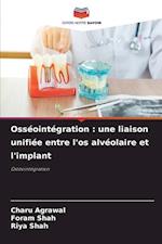 Osséointégration : une liaison unifiée entre l'os alvéolaire et l'implant