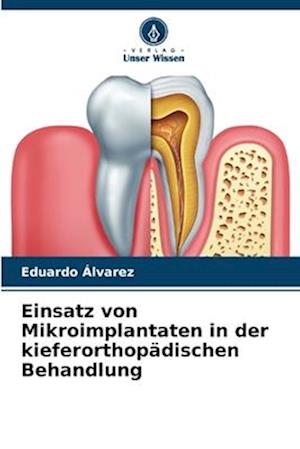 Einsatz von Mikroimplantaten in der kieferorthopädischen Behandlung