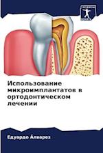 Ispol'zowanie mikroimplantatow w ortodonticheskom lechenii