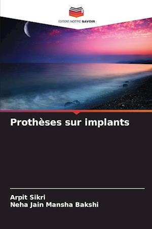 Prothèses sur implants