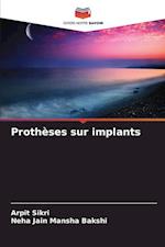 Prothèses sur implants