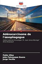 Adénocarcinome de l'¿sophagogue