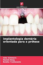 Implantologia dentária orientada para a prótese