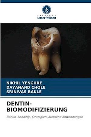 DENTIN-BIOMODIFIZIERUNG