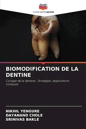 BIOMODIFICATION DE LA DENTINE