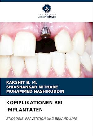 KOMPLIKATIONEN BEI IMPLANTATEN