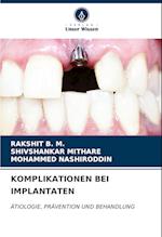 KOMPLIKATIONEN BEI IMPLANTATEN