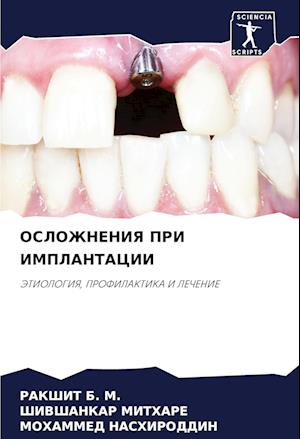 OSLOZhNENIYa PRI IMPLANTACII