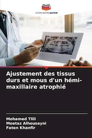 Ajustement des tissus durs et mous d'un hémi-maxillaire atrophié