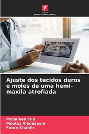 Ajuste dos tecidos duros e moles de uma hemi-maxila atrofiada