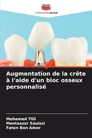 Augmentation de la crête à l'aide d'un bloc osseux personnalisé