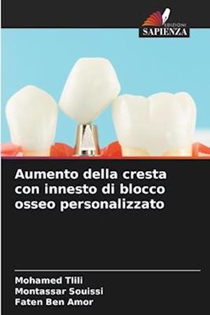 Aumento della cresta con innesto di blocco osseo personalizzato