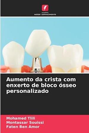 Aumento da crista com enxerto de bloco ósseo personalizado