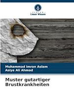 Muster gutartiger Brustkrankheiten