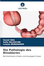 Die Pathologie des Blinddarms