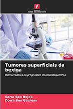 Tumores superficiais da bexiga